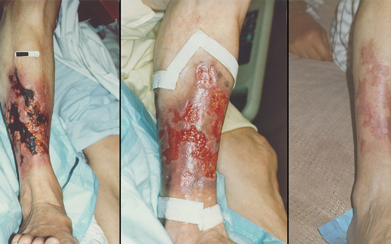 Green botte fly maggot